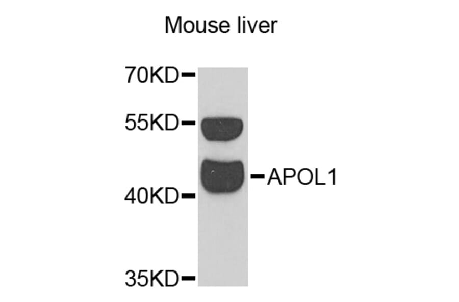 Western Blot - Anti-APOL1 Antibody (A13376) - Antibodies.com