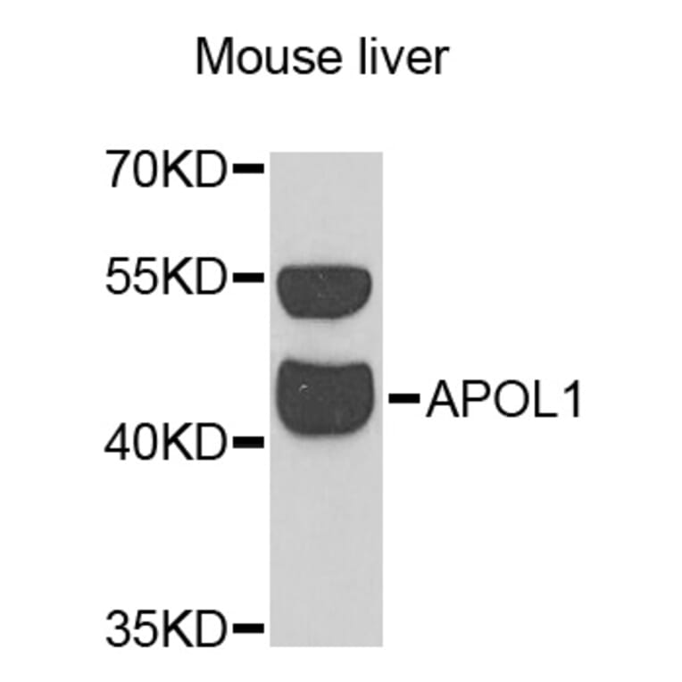 Western Blot - Anti-APOL1 Antibody (A13376) - Antibodies.com