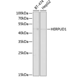 Western Blot - Anti-HERPUD1 Antibody (A89908) - Antibodies.com