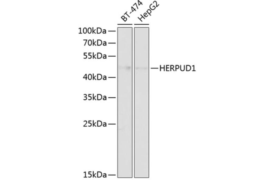 Western Blot - Anti-HERPUD1 Antibody (A89908) - Antibodies.com