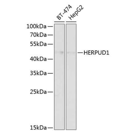 Western Blot - Anti-HERPUD1 Antibody (A89908) - Antibodies.com