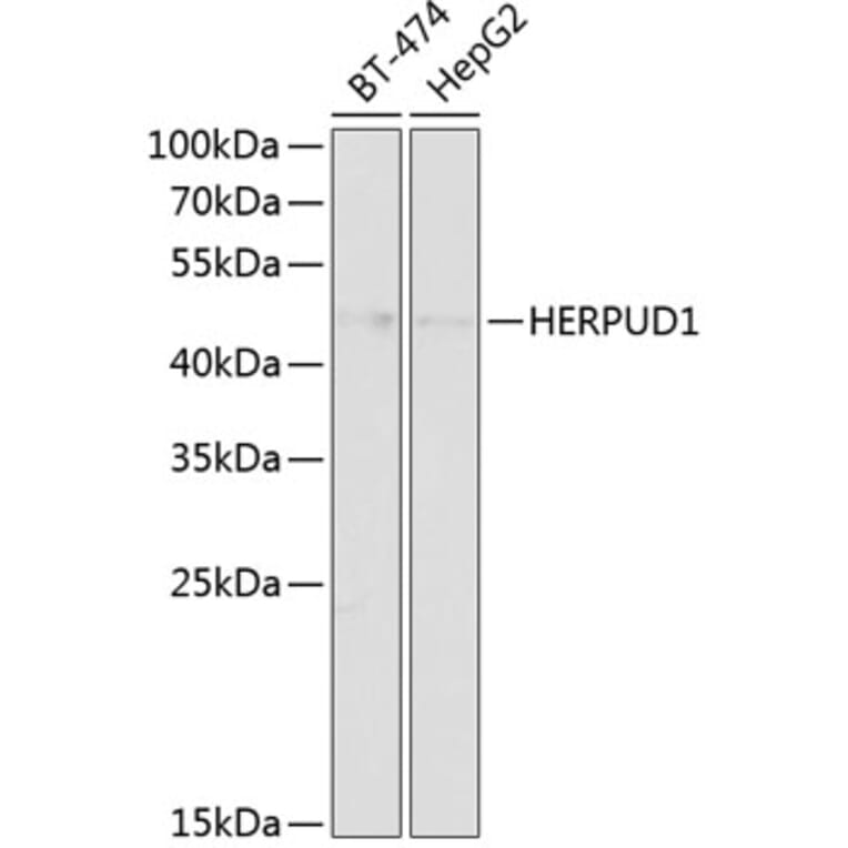 Western Blot - Anti-HERPUD1 Antibody (A89908) - Antibodies.com