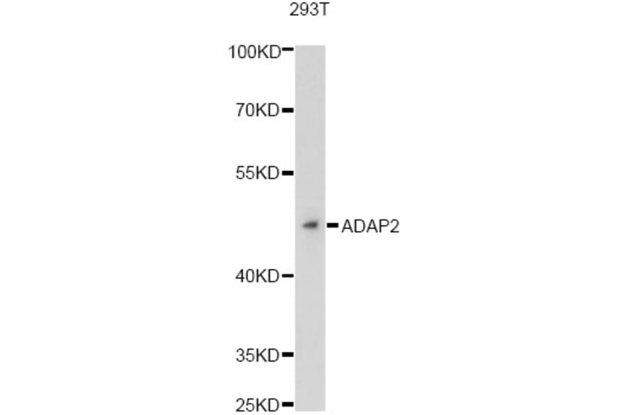 Western Blot - Anti-ADAP2 Antibody (A13739) - Antibodies.com