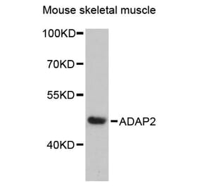 Western Blot - Anti-ADAP2 Antibody (A89910) - Antibodies.com