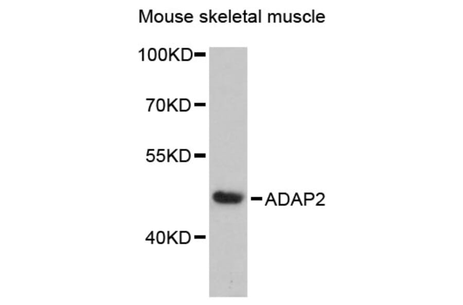 Western Blot - Anti-ADAP2 Antibody (A89910) - Antibodies.com