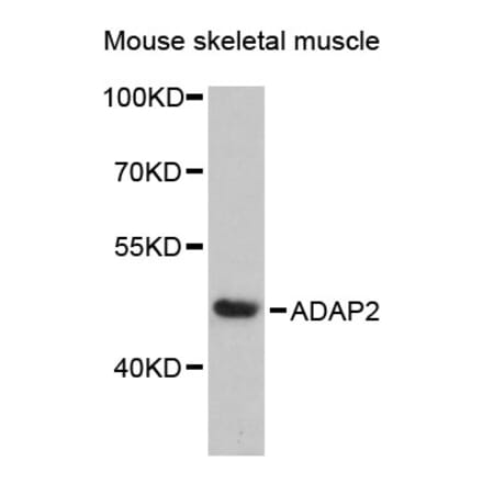 Western Blot - Anti-ADAP2 Antibody (A89910) - Antibodies.com