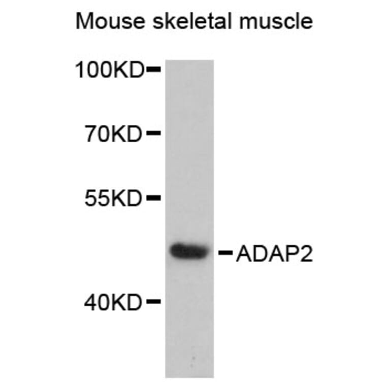 Western Blot - Anti-ADAP2 Antibody (A89910) - Antibodies.com