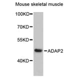 Western Blot - Anti-ADAP2 Antibody (A89910) - Antibodies.com