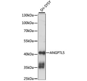 Western Blot - Anti-ANGPTL5 Antibody (A89911) - Antibodies.com
