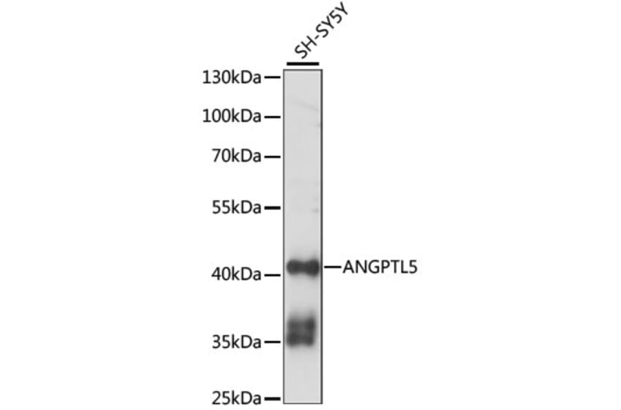 Western Blot - Anti-ANGPTL5 Antibody (A89911) - Antibodies.com