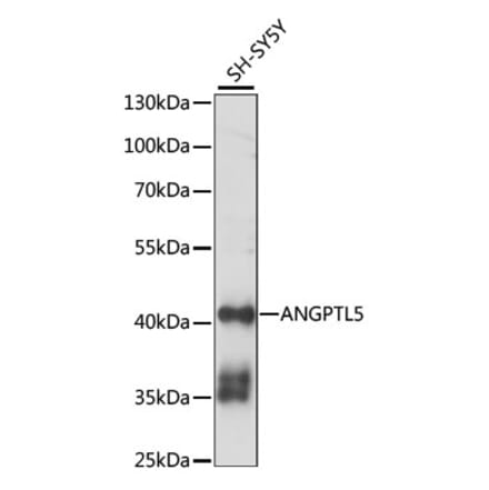 Western Blot - Anti-ANGPTL5 Antibody (A89911) - Antibodies.com