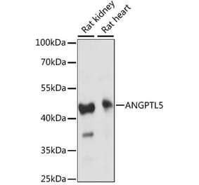 Western Blot - Anti-ANGPTL5 Antibody (A89912) - Antibodies.com