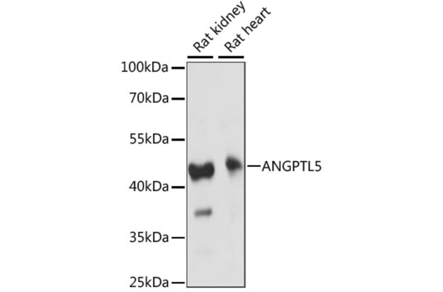 Western Blot - Anti-ANGPTL5 Antibody (A89912) - Antibodies.com