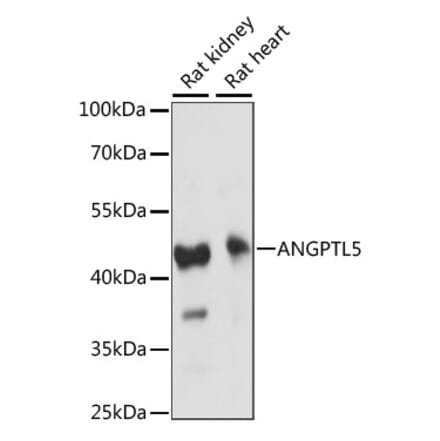 Western Blot - Anti-ANGPTL5 Antibody (A89912) - Antibodies.com