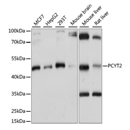 Western Blot - Anti-PCYT2 Antibody (A89913) - Antibodies.com