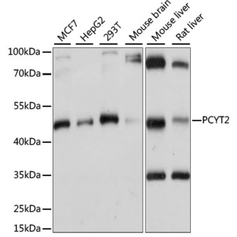 Western Blot - Anti-PCYT2 Antibody (A89913) - Antibodies.com