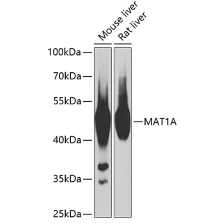 Western Blot - Anti-MAT1A Antibody (A89914) - Antibodies.com