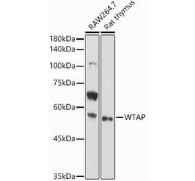 Western Blot - Anti-WTAP Antibody (A89915) - Antibodies.com