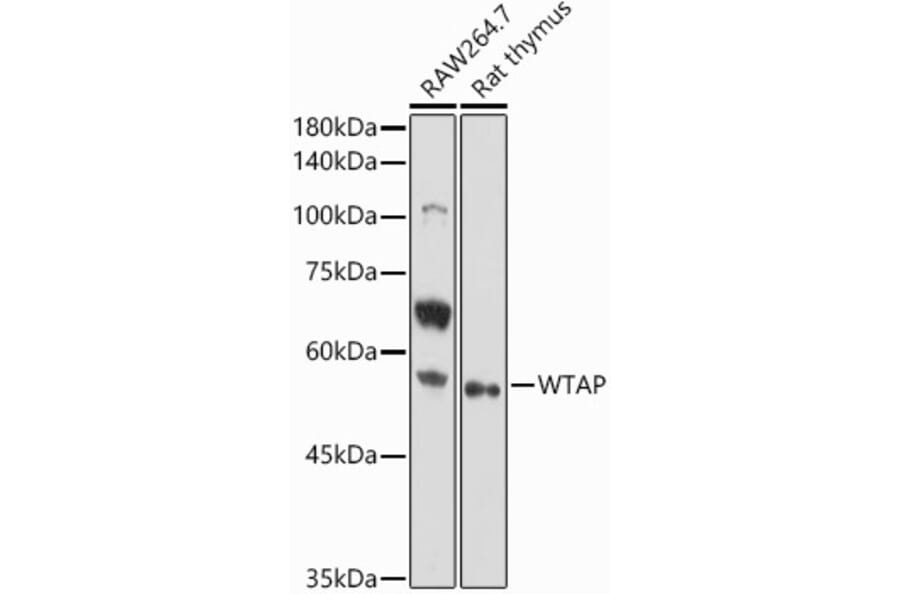 Western Blot - Anti-WTAP Antibody (A89915) - Antibodies.com