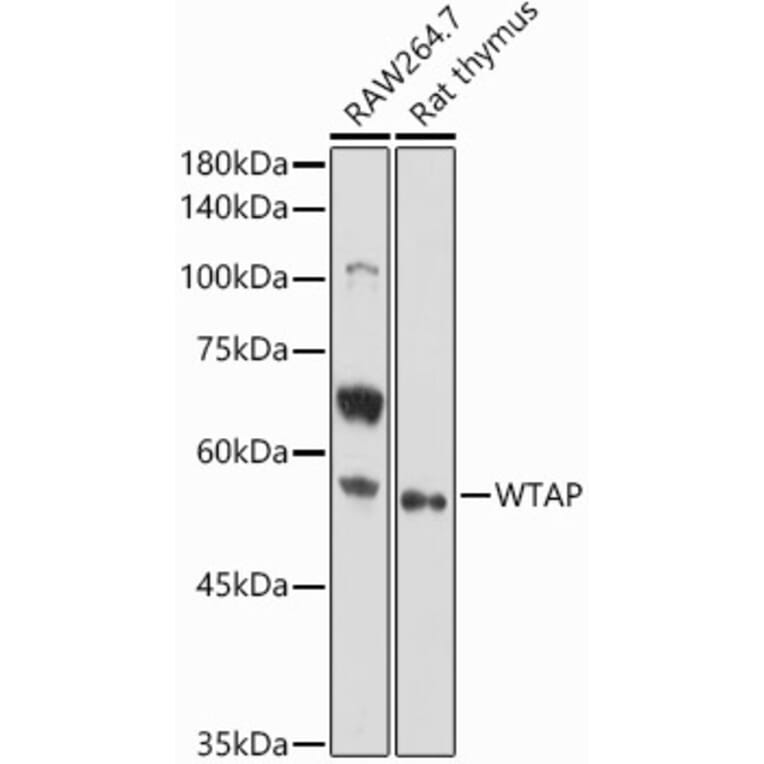 Western Blot - Anti-WTAP Antibody (A89915) - Antibodies.com
