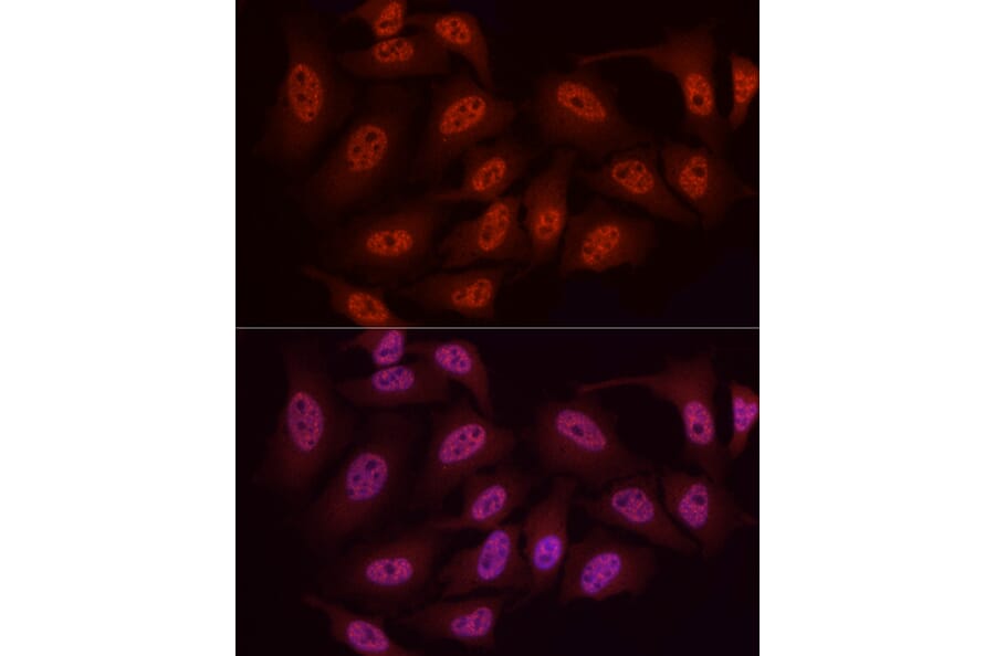 Immunofluorescence - Anti-WTAP Antibody (A89915) - Antibodies.com