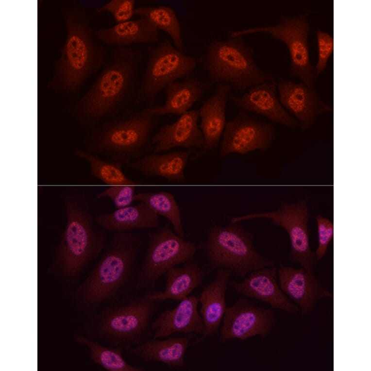Immunofluorescence - Anti-WTAP Antibody (A89915) - Antibodies.com