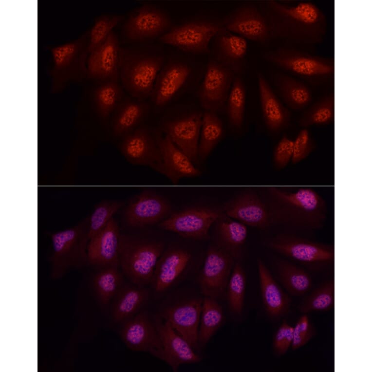 Immunofluorescence - Anti-WTAP Antibody (A89915) - Antibodies.com