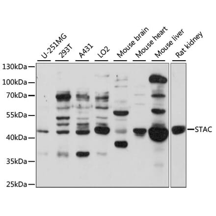 Western Blot - Anti-STAC Antibody (A89916) - Antibodies.com