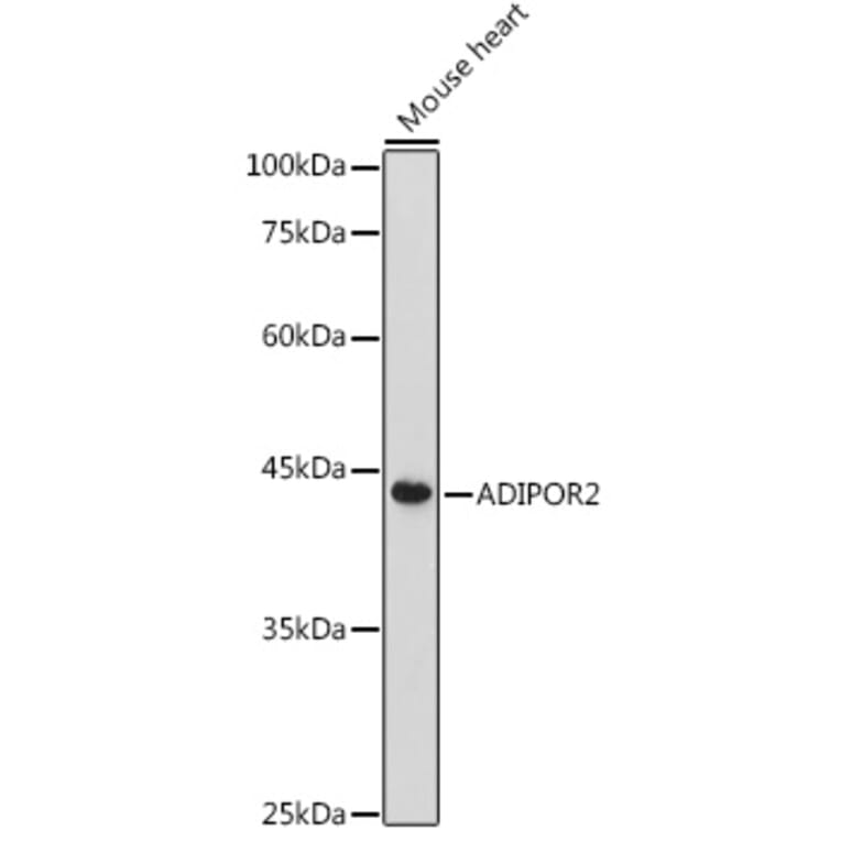Western Blot - Anti-Adiponectin Receptor 2/ADIPOR2 Antibody (A89917) - Antibodies.com