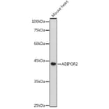Western Blot - Anti-Adiponectin Receptor 2/ADIPOR2 Antibody (A89917) - Antibodies.com