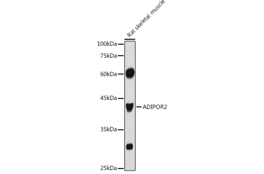 Western Blot - Anti-Adiponectin Receptor 2/ADIPOR2 Antibody (A89917) - Antibodies.com