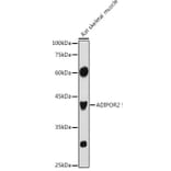 Western Blot - Anti-Adiponectin Receptor 2/ADIPOR2 Antibody (A89917) - Antibodies.com
