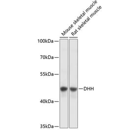 Western Blot - Anti-Dhh Antibody (A89918) - Antibodies.com