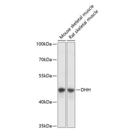 Western Blot - Anti-Dhh Antibody (A89918) - Antibodies.com