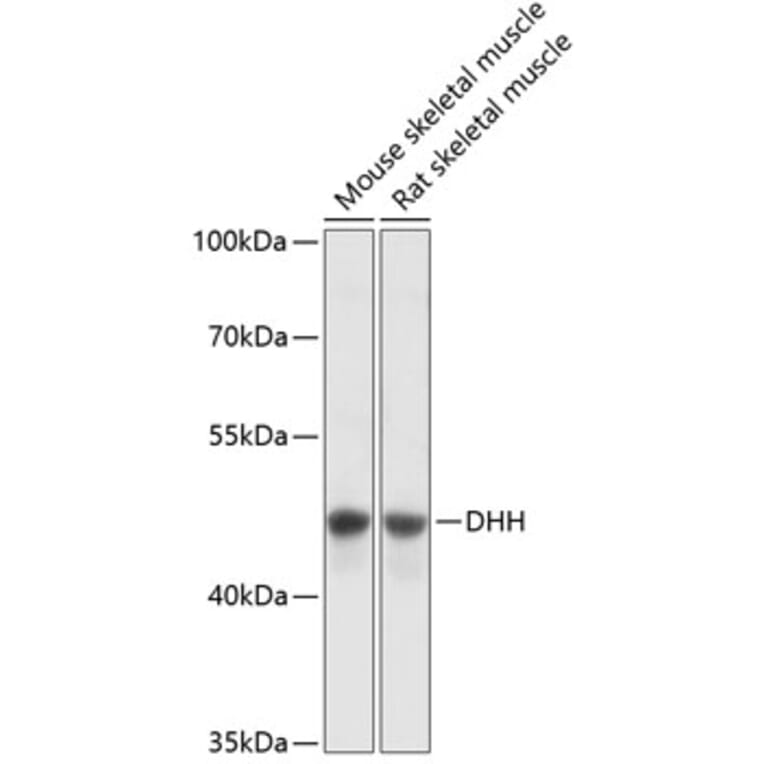 Western Blot - Anti-Dhh Antibody (A89918) - Antibodies.com