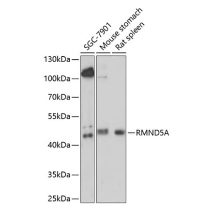 Western Blot - Anti-RMND5A Antibody (A89919) - Antibodies.com