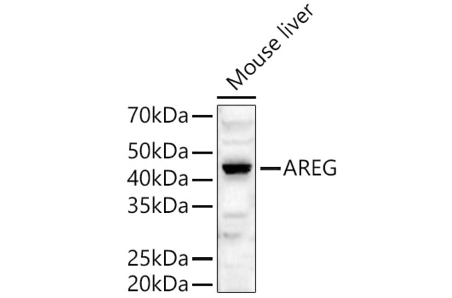 Western Blot - Anti-Amphiregulin Antibody (A89920) - Antibodies.com