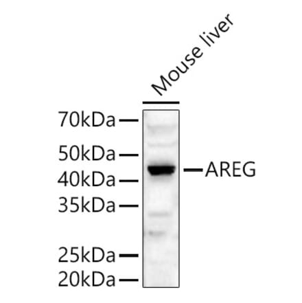 Western Blot - Anti-Amphiregulin Antibody (A89920) - Antibodies.com