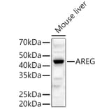 Western Blot - Anti-Amphiregulin Antibody (A89920) - Antibodies.com