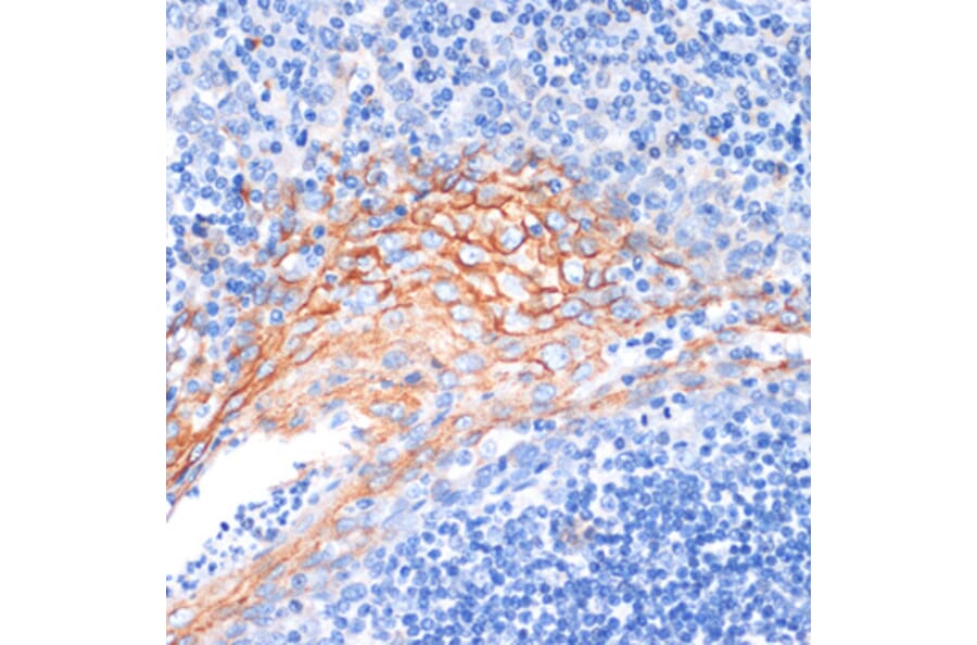Immunohistochemistry - Anti-Amphiregulin Antibody (A89920) - Antibodies.com