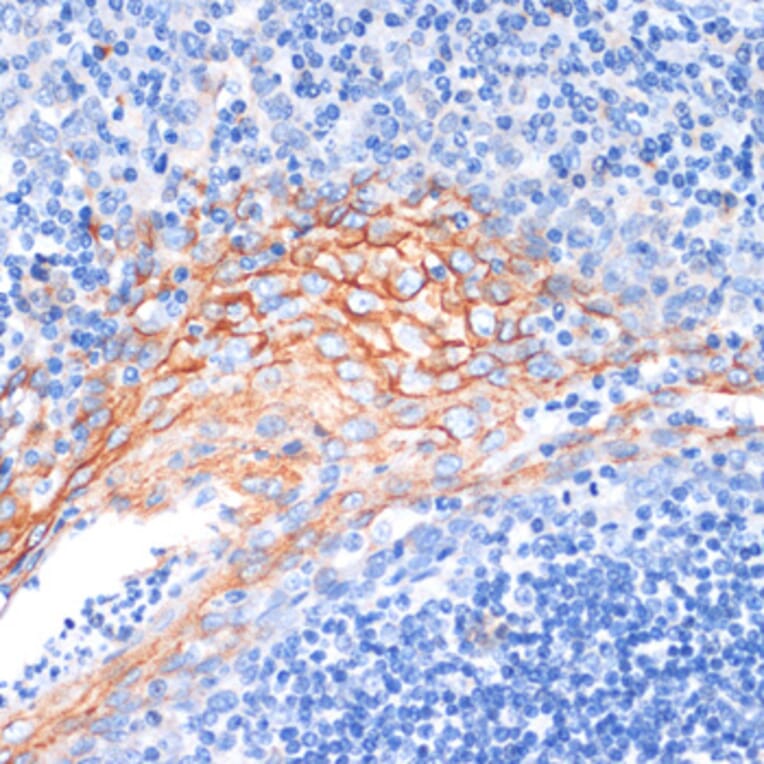 Immunohistochemistry - Anti-Amphiregulin Antibody (A89920) - Antibodies.com