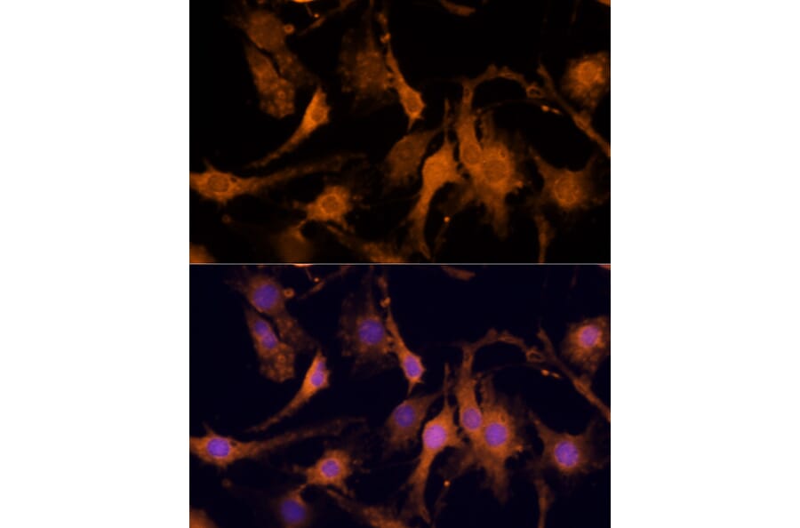 Immunofluorescence - Anti-Amphiregulin Antibody (A89920) - Antibodies.com