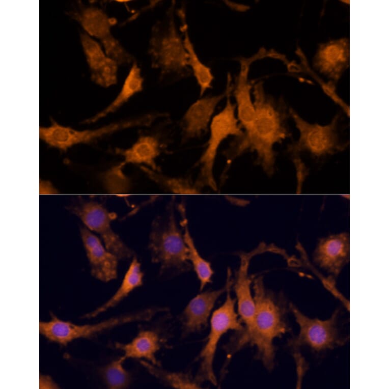Immunofluorescence - Anti-Amphiregulin Antibody (A89920) - Antibodies.com