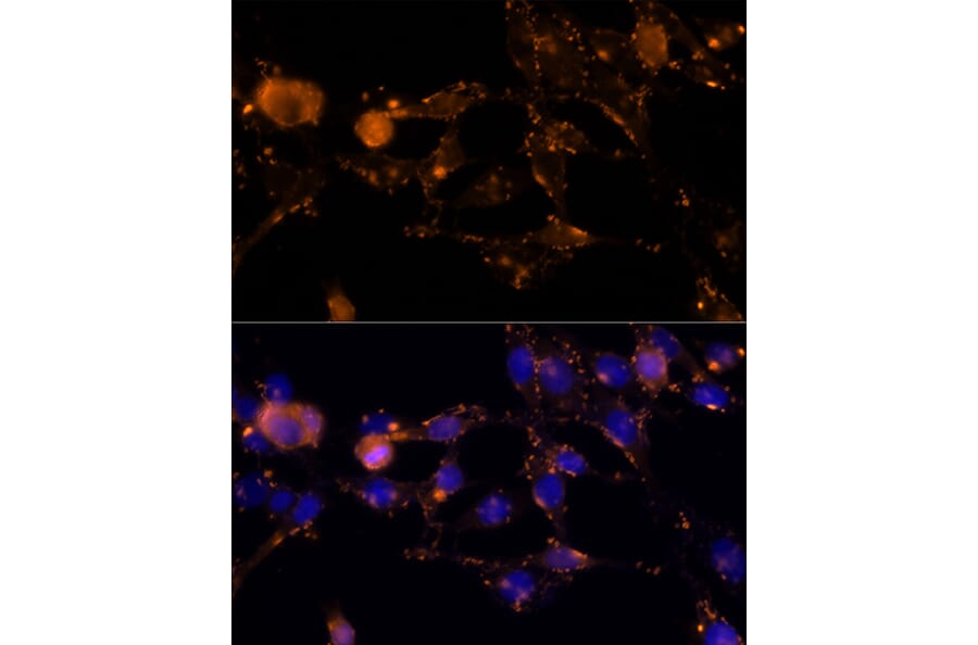 Immunofluorescence - Anti-Amphiregulin Antibody (A89920) - Antibodies.com