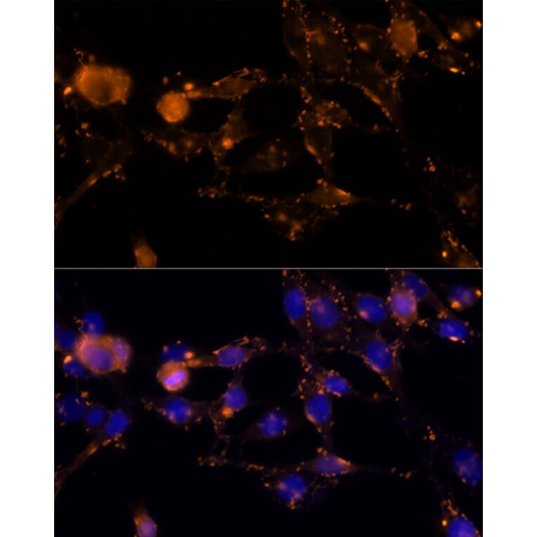 Immunofluorescence - Anti-Amphiregulin Antibody (A89920) - Antibodies.com