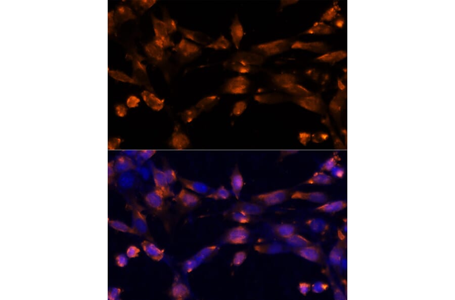 Immunofluorescence - Anti-Amphiregulin Antibody (A89920) - Antibodies.com