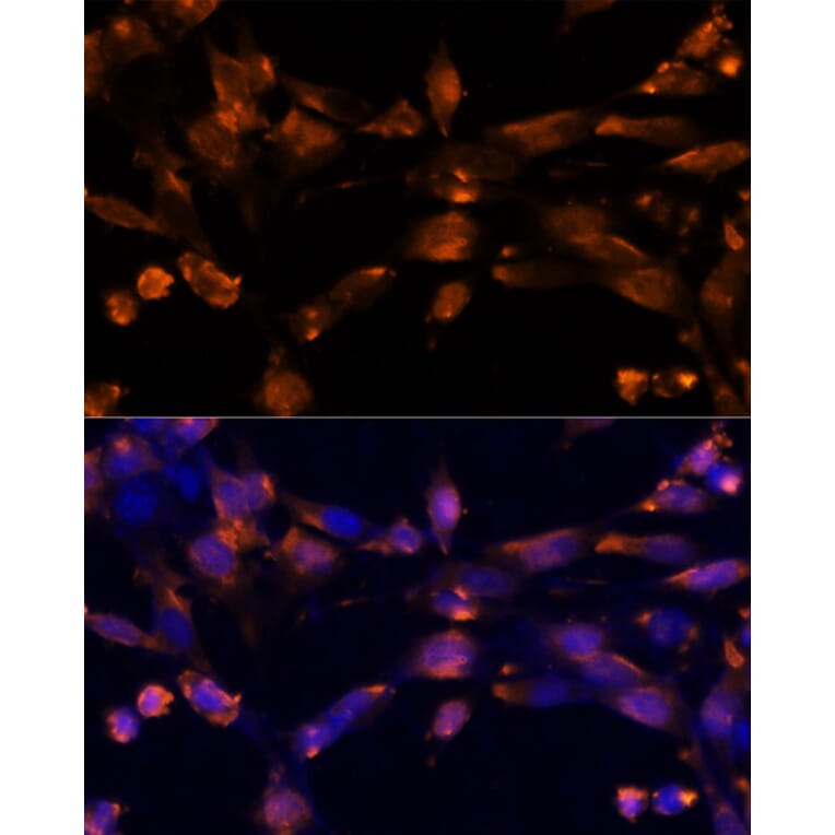 Immunofluorescence - Anti-Amphiregulin Antibody (A89920) - Antibodies.com
