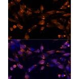 Immunofluorescence - Anti-Amphiregulin Antibody (A89920) - Antibodies.com