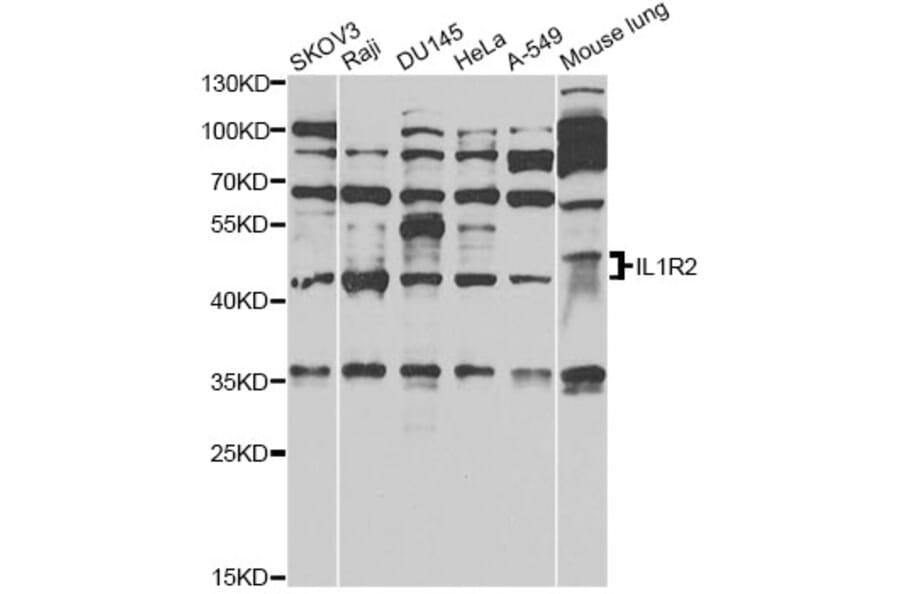 Western Blot - Anti-IL1R2 Antibody (A14072) - Antibodies.com