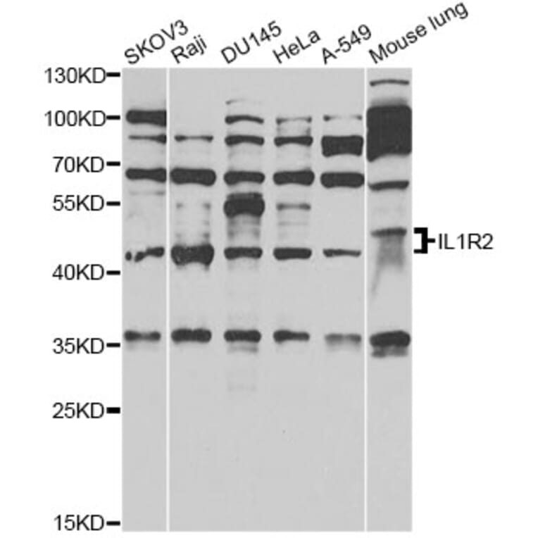 Western Blot - Anti-IL1R2 Antibody (A14072) - Antibodies.com